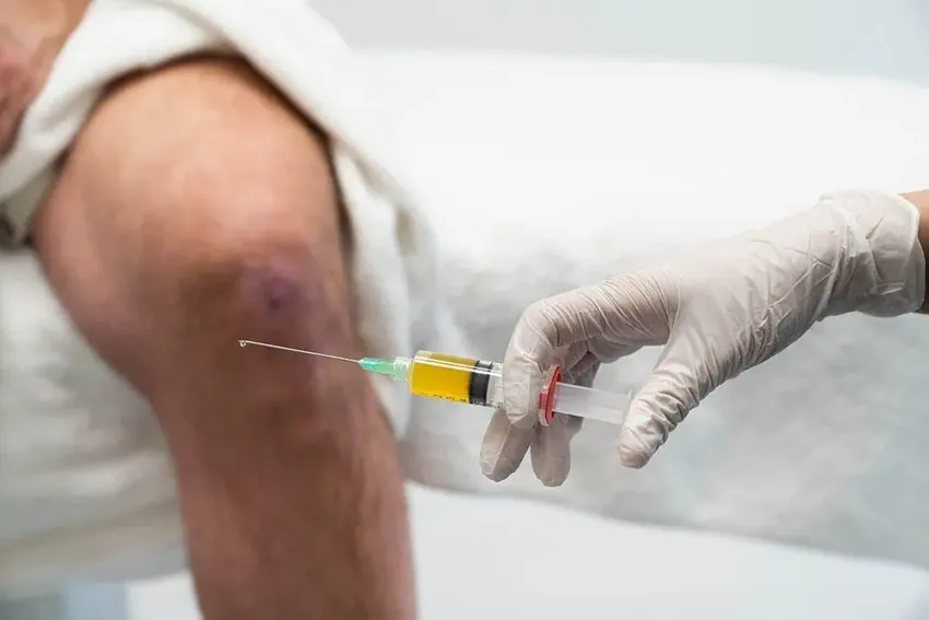 Ärztliche Injektion ins Kniegelenk zur Behandlung von Arthrose und Knieschmerzen